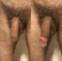 Uncut_penis_with_foreskin_on_and_rolled_back.jpg