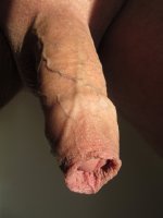 Close-up_of_human_foreskin.jpg